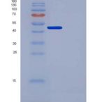 人尿激酶/ uPA重组蛋白His Tag