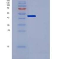 人尿激酶/ uPA重组蛋白His Tag