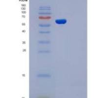 人腺苷裂解酶(ADSL)重组蛋白His tag