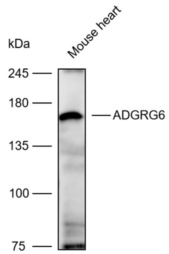 Anti-ADGRG6 Polyclonal Antibod