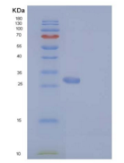 人RAS癌基因家族成员RAB27B(RAB27B)重组蛋白H