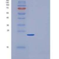 大鼠C反应蛋白(CRP)重组蛋白His tag