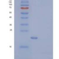 人CD137 / 4-1BB / TNFRSF9重组蛋白His tag