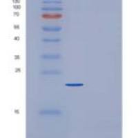 小鼠C反应蛋白(CRP)重组蛋白His tag