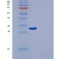 人IgG1 Fc 重组蛋白