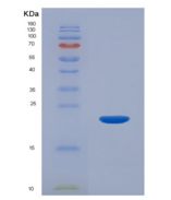 大鼠白介素1β(IL1b)重组蛋白