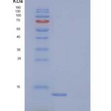 小鼠S100A11 / S100C重组蛋白His tag