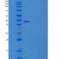 人抵抗素(RETN)重组蛋白Fc Tag