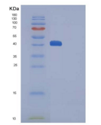 人CTLA4 / CD152重组蛋白His & Fc tag