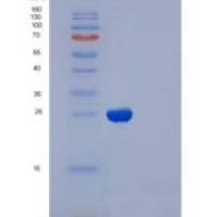 人CD122 / IL-2RB重组蛋白