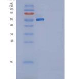 大鼠KIT / c-KIT重组蛋白His tag