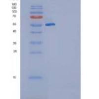 大鼠KIT / c-KIT重组蛋白His tag