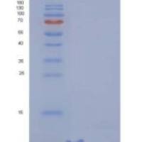 大鼠CLPS / Colipase重组蛋白His Tag