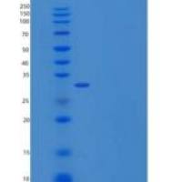 人谷胱甘肽S-转移酶θ-2B/gstt 2b重组蛋白His tag