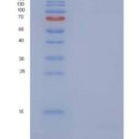 人硫氧还蛋白/ TXN / SASP重组蛋白