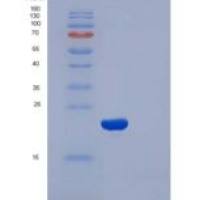 人CFL2 / cofilin 2 / ADF重组蛋白His tag