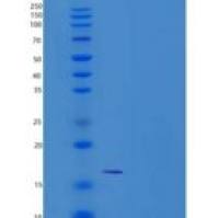 小鼠CD302 / CLEC13A重组蛋白His tag