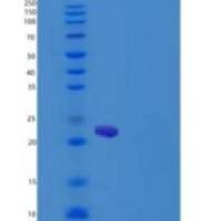 大鼠白介素6(IL6)重组蛋白