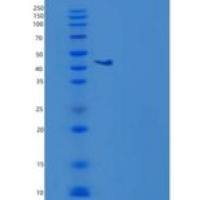 人白细胞衍生趋化因子1(LECT1)重组蛋白Fc Tag