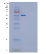 大鼠KIT / c-KIT重组蛋白His tag
