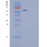 大鼠IL-6R / CD126重组蛋白Fc tag, ECD