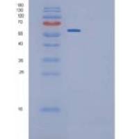 大鼠IL-6R / CD126重组蛋白Fc tag, ECD
