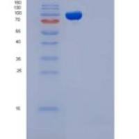 小鼠ICAM-1 / CD54重组蛋白His & Fc tag