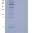 人子宫珠蛋白/ SCGB1A1重组蛋白His tag