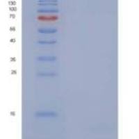 人子宫珠蛋白/ SCGB1A1重组蛋白His tag