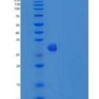 小鼠R-脊椎蛋白1(RSPO1)重组蛋白His tag