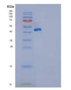 大鼠DDR2 Kinase / CD167b重组蛋白His 