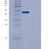 人尿激酶/ PLAU重组蛋白His tag