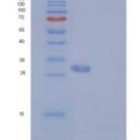 人RAS癌基因家族成员RAB27B(RAB27B)重组蛋白His tag