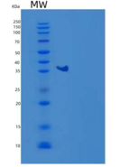 人GPD1/GDP-C重组蛋白C-6His