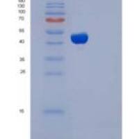 人钴胺传递蛋白Ⅱ(TCN2)重组蛋白His tag