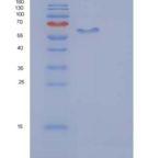 人AFM / Afamin重组蛋白His tag
