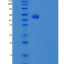 人肿瘤坏死因子相关配体分子1A(TL1A)重组蛋白Fc Tag