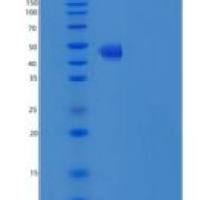 人肿瘤坏死因子相关配体分子1A(TL1A)重组蛋白Fc Tag