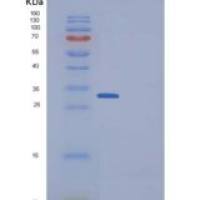 人DKK1 / Dkk-1重组蛋白His tag