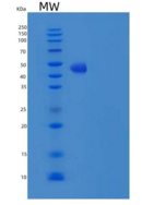 人肿瘤坏死因子相关配体分子1A(TL1A)重组蛋白Fc Ta