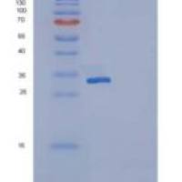 人Osteonectin / SPARC重组蛋白His tag