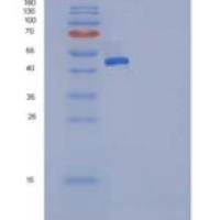 人SerpinG1 / C1 inhibitor / C1IN重组蛋白His tag