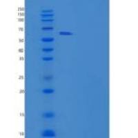 大鼠gp130 / IL6ST / CD130重组蛋白His tag