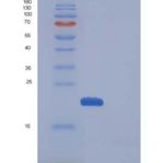 小鼠CDNF / ARMETL1重组蛋白His tag