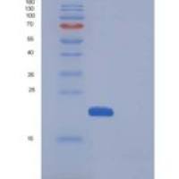 小鼠CDNF / ARMETL1重组蛋白His tag