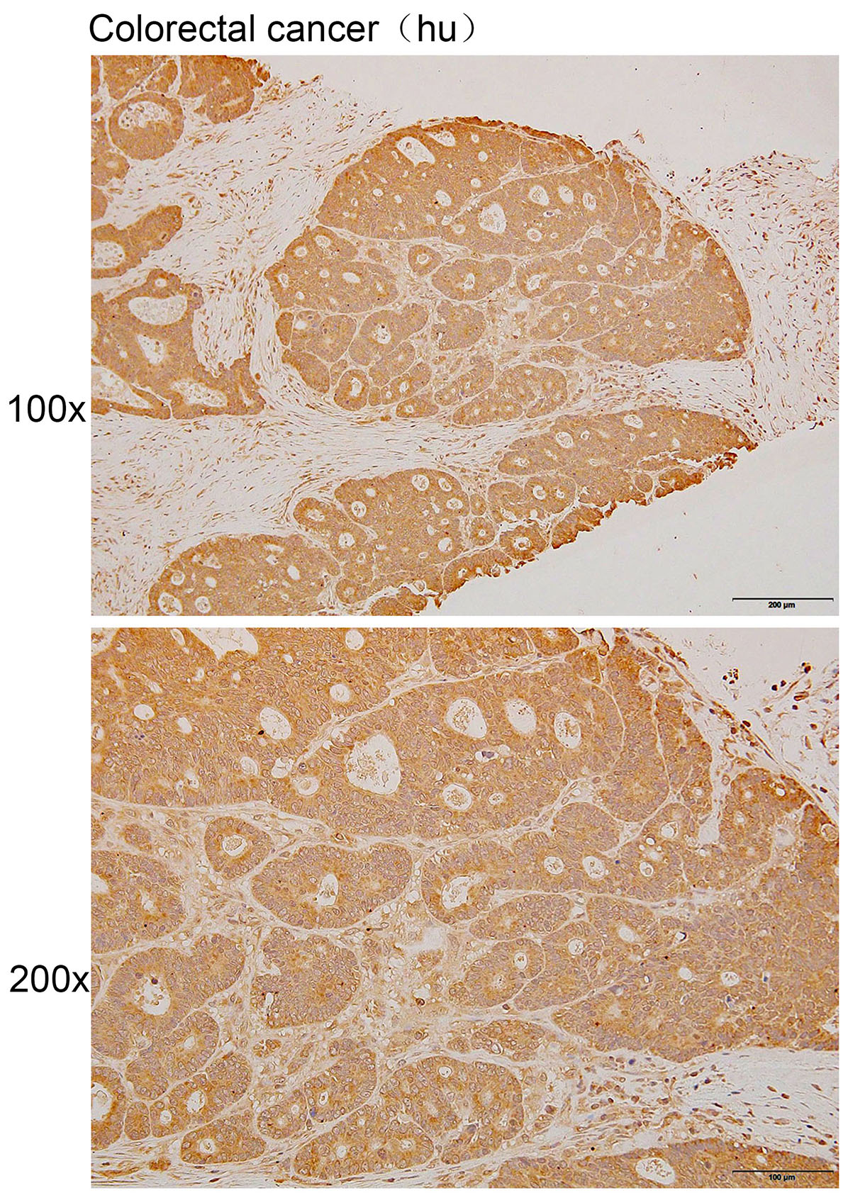 Anti-AFTPH Polyclonal Antibody
