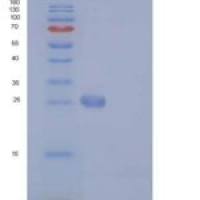 人BCL2L1 / Bcl-XL重组蛋白His tag