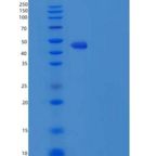 小鼠色素上皮衍生因子(PEDF)重组蛋白His Tag