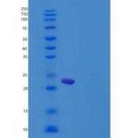大鼠胰岛素样生长因子结合蛋白6(IGFBP6)重组蛋白His Tag