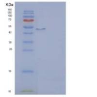 人IL2RG / CD132重组蛋白Fc tag